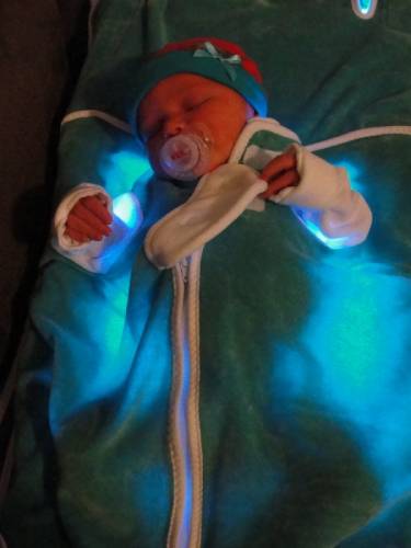 Лампа фототерапии от желтушки новорожденных 